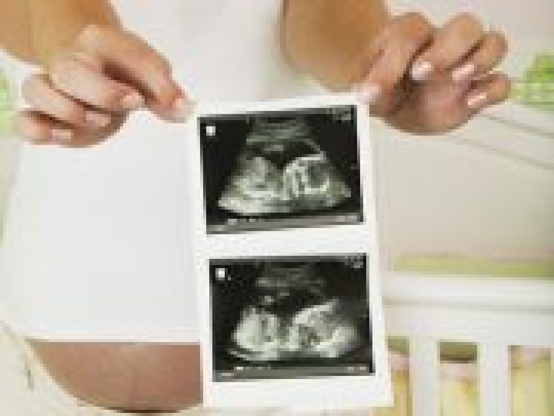 10 Verites Sur L Echographie