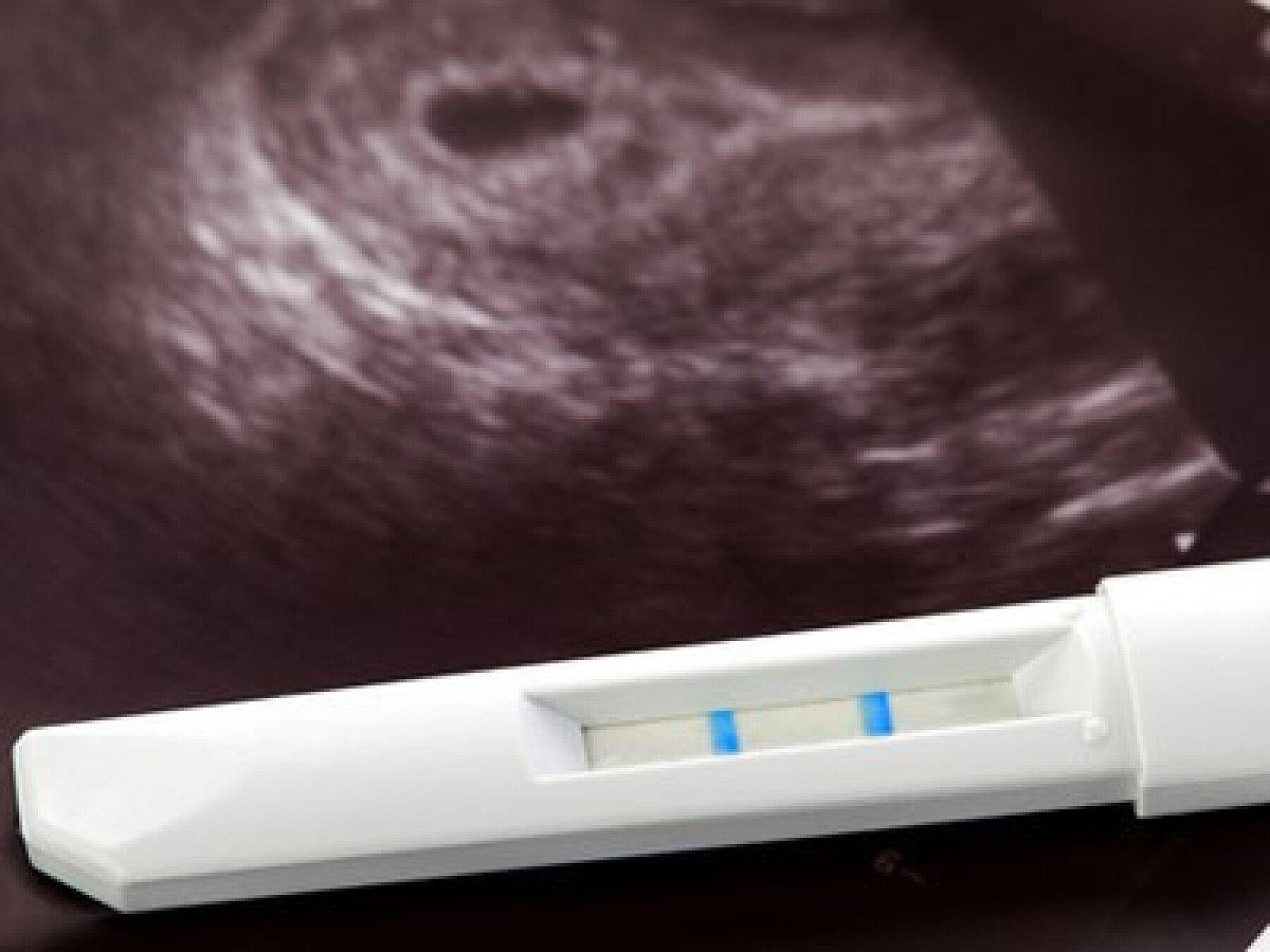 Quand Son Cœur Bat Il In Utero Quand Son Cœur Bat Il In Utero