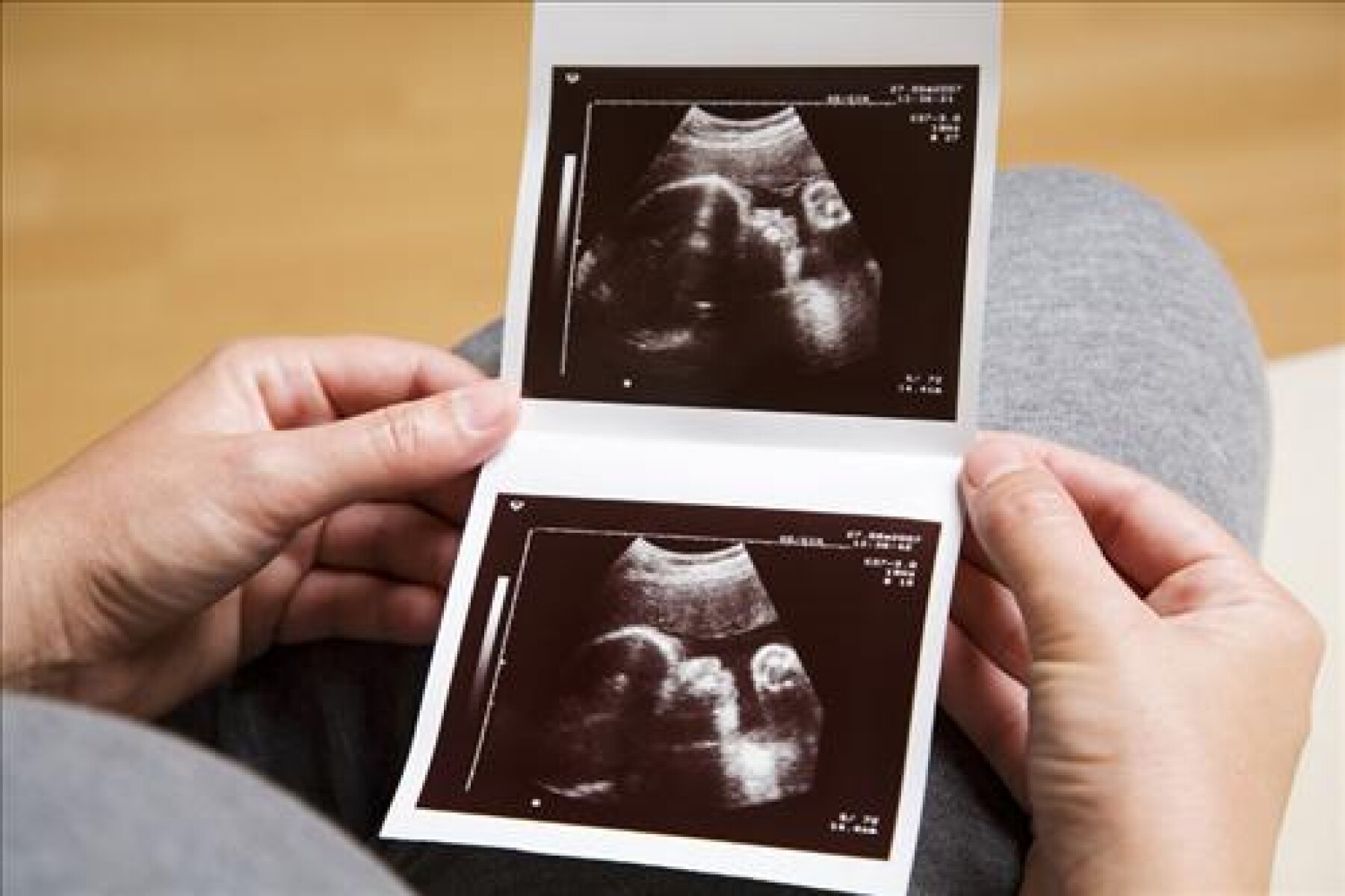 La Troisieme Echographie